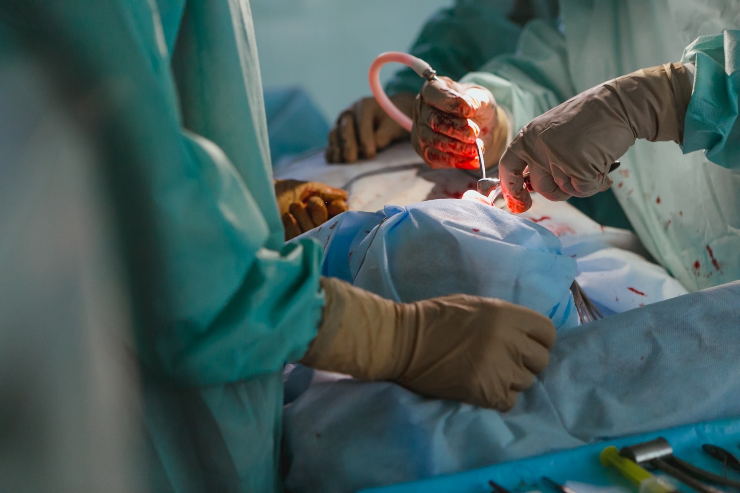 Guia prático para reduzir o inchaço pós-operatório